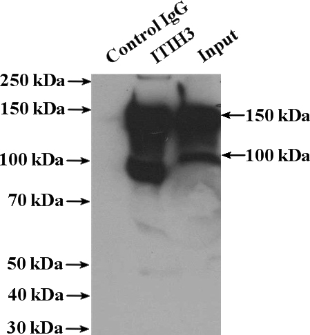 IP Result of anti-ITIH3 (IP:Catalog No:111948, 4ug; Detection:Catalog No:111948 1:1000) with human plasma tissue lysate 4000ug.