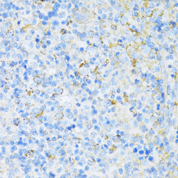 Immunohistochemistry - VAMP1 Polyclonal Antibody 