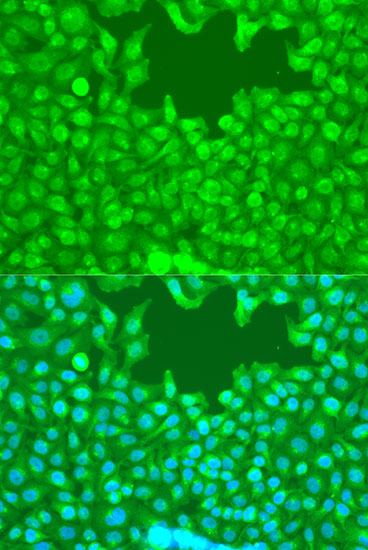 Immunofluorescence - TAZ Polyclonal Antibody 