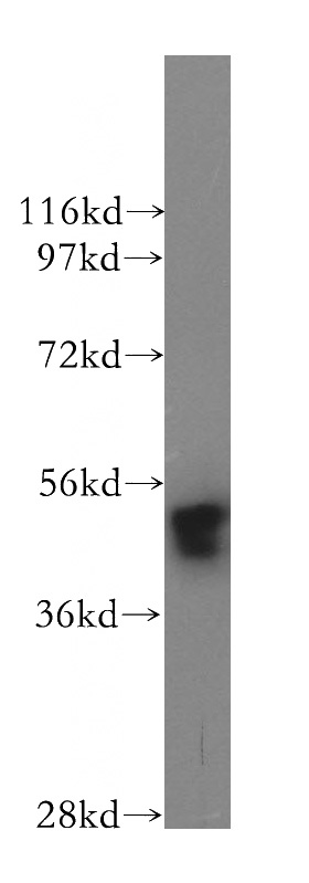 K-562 cells were subjected to SDS PAGE followed by western blot with Catalog No:111046(GOPC antibody) at dilution of 1:800