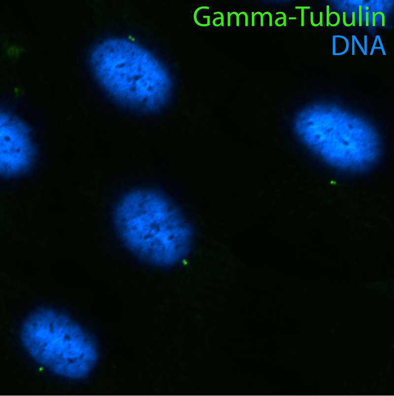 IF results of gamma tubulin antibody (Catalog No:110859, 1:100) with hTERT-RPE cells by Moshe Kim (laboratory of Dr. William S Trimble, University of Toronto). Cells were fixed in ice-cold methanol.