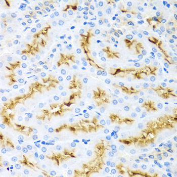 Immunohistochemistry - CCL22 Polyclonal Antibody 
