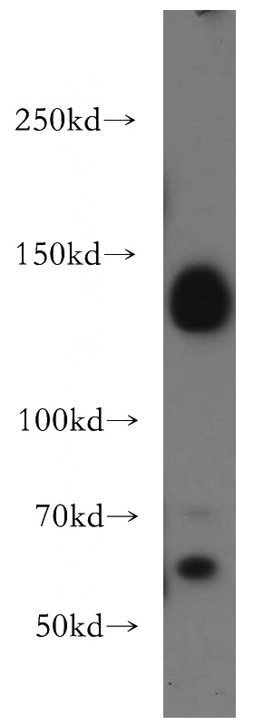 HEK-293 cells were subjected to SDS PAGE followed by western blot with Catalog No:109969(DNMT3A antibody) at dilution of 1:1500