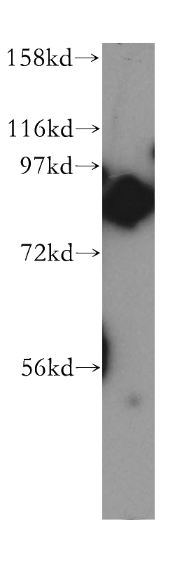 HeLa cells were subjected to SDS PAGE followed by western blot with Catalog No:116072(TLK2 antibody) at dilution of 1:800