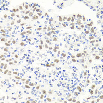 Immunohistochemistry - EXO1 Polyclonal Antibody 