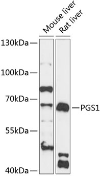 Western blot - PGS1 Polyclonal Antibody 