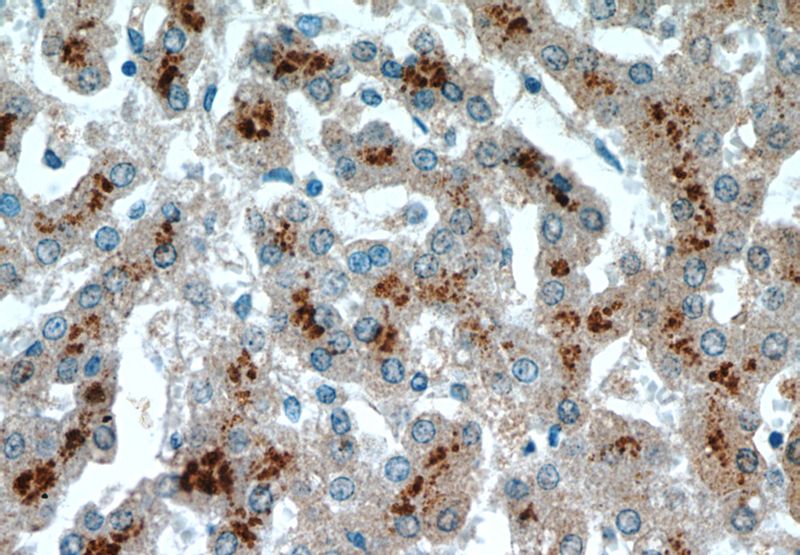 Immunohistochemical of paraffin-embedded human liver using Catalog No:107068(ASS1 antibody) at dilution of 1:50 (under 40x lens)
