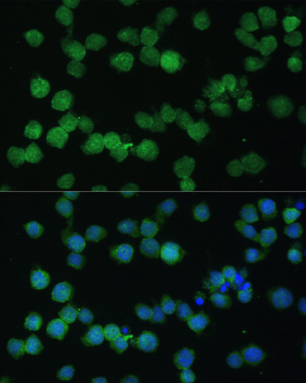 Immunofluorescence - CR1 Polyclonal Antibody 