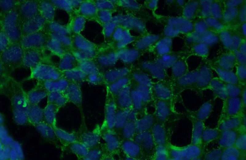 Immunofluorescent analysis of (10% Formaldehyde) fixed HEK-293 cells using Catalog No:115682(STARD8 Antibody) at dilution of 1:50 and Alexa Fluor 488-congugated AffiniPure Goat Anti-Rabbit IgG(H+L)