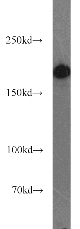 mouse brain tissue were subjected to SDS PAGE followed by western blot with Catalog No:108882(CASPR antibody) at dilution of 1:500