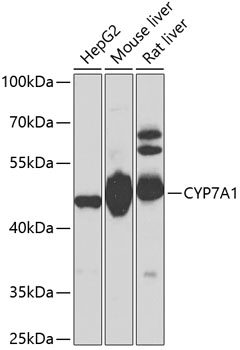 Western blot - CYP7A1 Polyclonal Antibody 