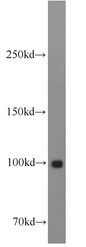 HeLa cells were subjected to SDS PAGE followed by western blot with Catalog No:111911(KAP1 antibody) at dilution of 1:3000