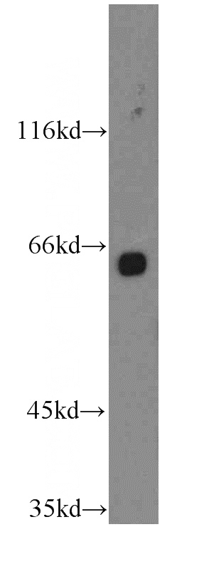 mouse kidney tissue were subjected to SDS PAGE followed by western blot with Catalog No:116079(TM7SF3 antibody) at dilution of 1:1000