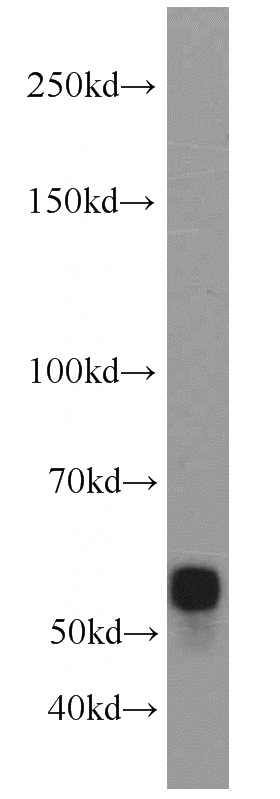 mouse brain tissue were subjected to SDS PAGE followed by western blot with Catalog No:115433(SMARCD1 antibody) at dilution of 1:600