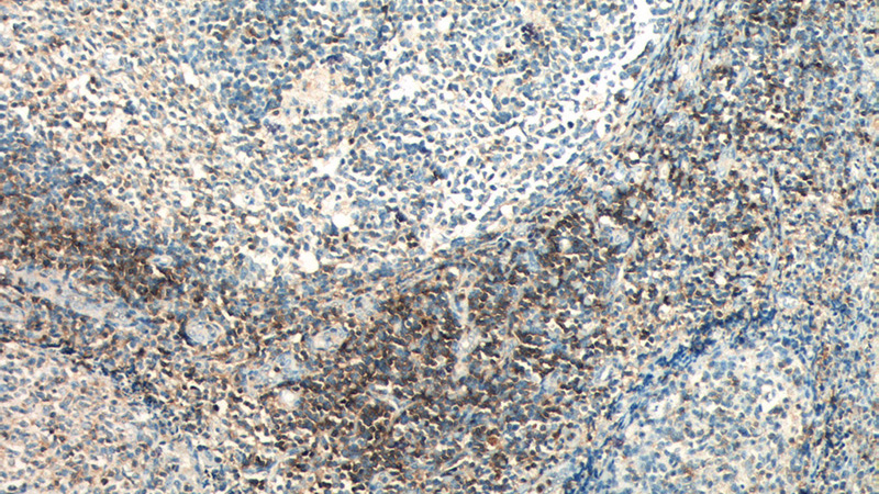 Immunohistochemistry of paraffin-embedded human tonsillitis tissue slide using Catalog No:107130(CD3G Antibody) at dilution of 1:400 (under 10x lens). heat mediated antigen retrieved with Sodium Citrate buffer (pH6).