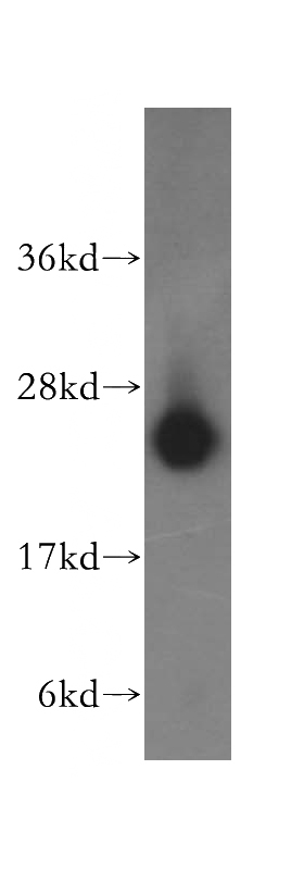 HeLa cells were subjected to SDS PAGE followed by western blot with Catalog No:112409(LYPLA1 antibody) at dilution of 1:500