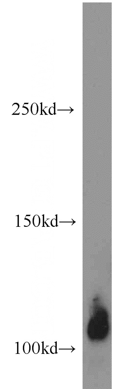 human heart tissue were subjected to SDS PAGE followed by western blot with Catalog No:116054(THBD antibody) at dilution of 1:500