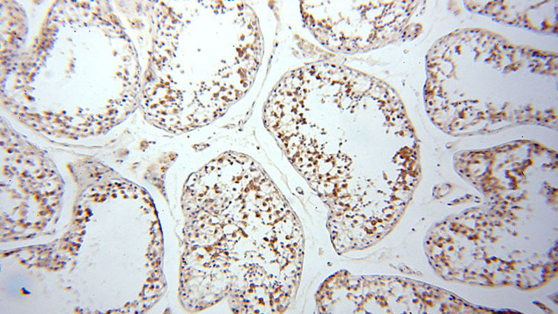 Immunohistochemical of paraffin-embedded human testis using Catalog No:115959(TEX14 antibody) at dilution of 1:50 (under 10x lens)