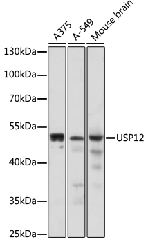 Western blot - USP12 Polyclonal Antibody 