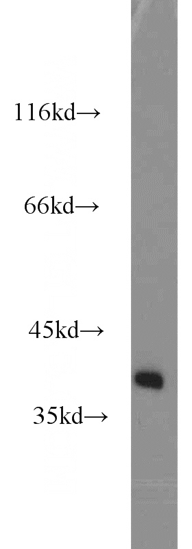 human brain tissue were subjected to SDS PAGE followed by western blot with Catalog No:115260(SH3GL3 antibody) at dilution of 1:800