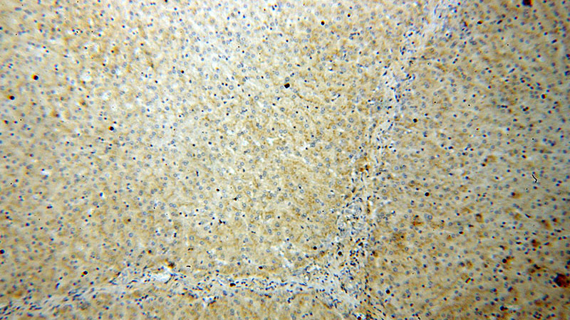 Immunohistochemical of paraffin-embedded human liver using Catalog No:116759(VDBP,GC antibody) at dilution of 1:100 (under 10x lens)