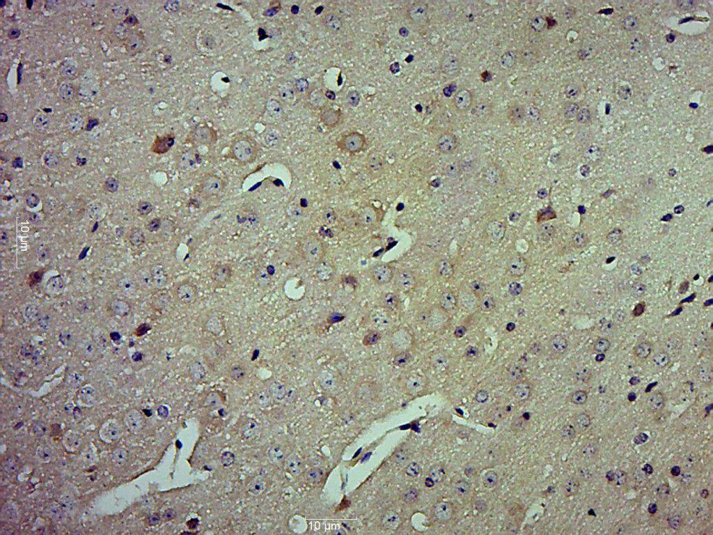Fig2: Paraformaldehyde-fixed, paraffin embedded (Mouse brain); Antigen retrieval by boiling in sodium citrate buffer (pH6.0) for 15min; Block endogenous peroxidase by 3% hydrogen peroxide for 20 minutes; Blocking buffer (normal goat serum) at 37℃ for 30min; Antibody incubation with (HSPA12A) Polyclonal Antibody, Unconjugated at 1:500 overnight at 4℃, followed by a conjugated secondary (sp-0023) for 20 minutes and DAB staining.