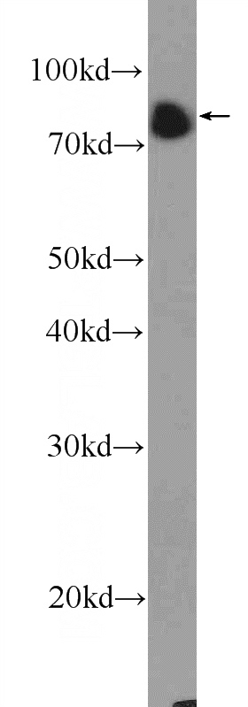 Raji cells were subjected to SDS PAGE followed by western blot with Catalog No:117102(BCL6 Antibody) at dilution of 1:1500