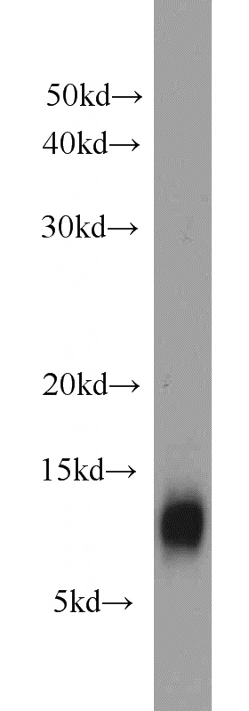 BxPC-3 cells were subjected to SDS PAGE followed by western blot with Catalog No:116890(YPEL3 antibody) at dilution of 1:1000