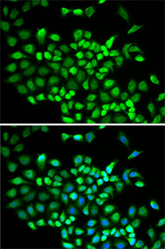 Immunofluorescence - CUL2 Polyclonal Antibody 