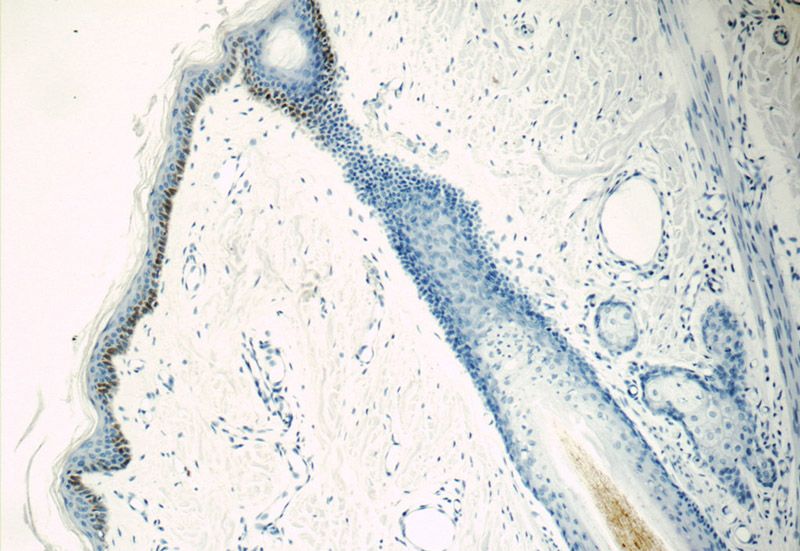 Immunohistochemistry of paraffin-embedded human skin tissue slide using Catalog No:111904(KLK5 Antibody) at dilution of 1:50 (under 10x lens)