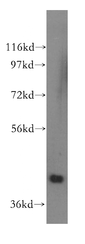 human brain tissue were subjected to SDS PAGE followed by western blot with Catalog No:114208(PRMT6 antibody) at dilution of 1:500