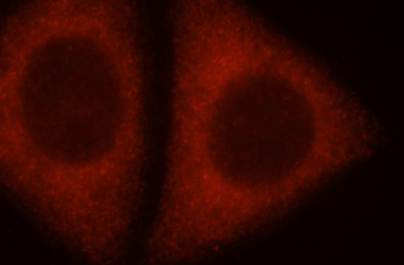 Immunofluorescent analysis of HepG2 cells, using ADAM12 antibody Catalog No:107761 at 1:25 and Rhodamine-labeled goat anti-rabbit IgG (red).