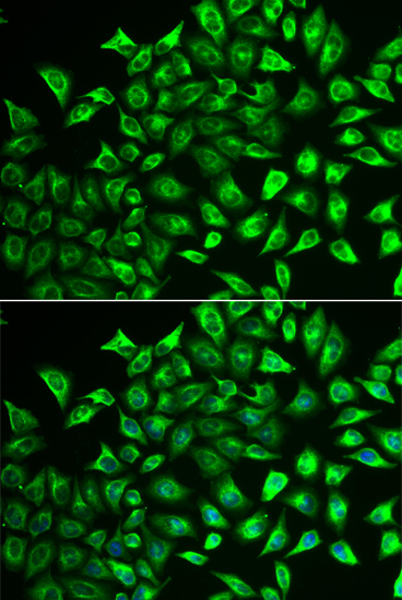 Immunofluorescence - MMRN1 Polyclonal Antibody 