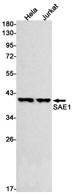 Western blot detection of SAE1 in Hela,Jurkat cell lysates using SAE1 Rabbit mAb(1:500 diluted).Predicted band size:39kDa.Observed band size:39kDa.