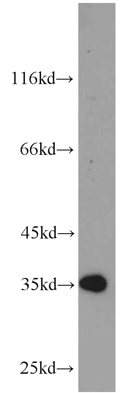 HepG2 cells were subjected to SDS PAGE followed by western blot with Catalog No:110954(GFRA2 antibody) at dilution of 1:1000