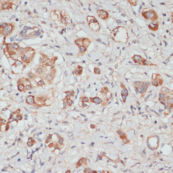 Immunohistochemistry - TES Polyclonal Antibody 