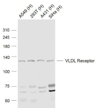 Fig1:; Sample:; Lane 1: A549 (Human) Cell Lysate at 30 ug; Lane 2: 293T (Human) Cell Lysate at 30 ug; Lane 3: A431 (Human) Cell Lysate at 30 ug; Lane 4: SiHa (Human) Cell Lysate at 30 ug; Primary: Anti-VLDL Receptor at 1/1000 dilution; Secondary: Goat Anti-Rabbit IgG at 1/20000 dilution; Predicted band size: 120 kD; Observed band size: 120 kD