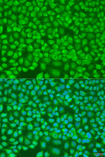 Immunofluorescence - PNKD Polyclonal Antibody 