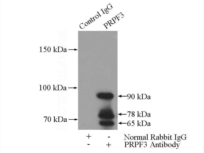 IP Result of anti-PRPF3 (IP:Catalog No:114228, 5ug; Detection:Catalog No:114228 1:500) with mouse liver tissue lysate 4000ug.