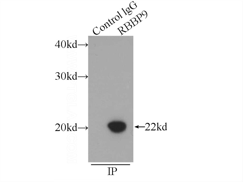 IP Result of anti-RBBP9 (IP:Catalog No:114594, 3ug; Detection:Catalog No:114594 1:300) with mouse lung tissue lysate 5160ug.