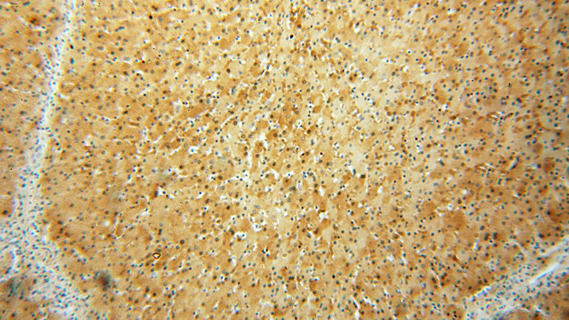 Immunohistochemical of paraffin-embedded human liver using Catalog No:115492(SOD1 antibody) at dilution of 1:100 (under 10x lens)