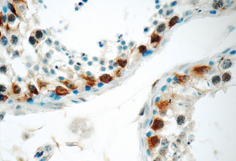 Immunohistochemistry of paraffin-embedded human testis tissue slide using Catalog No:116399(TRMT6 Antibody) at dilution of 1:50 (under 40x lens)