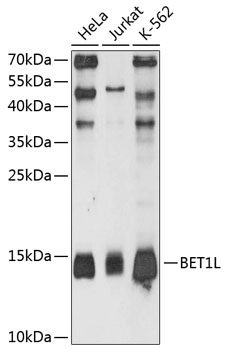 Western blot - BET1L Polyclonal Antibody 