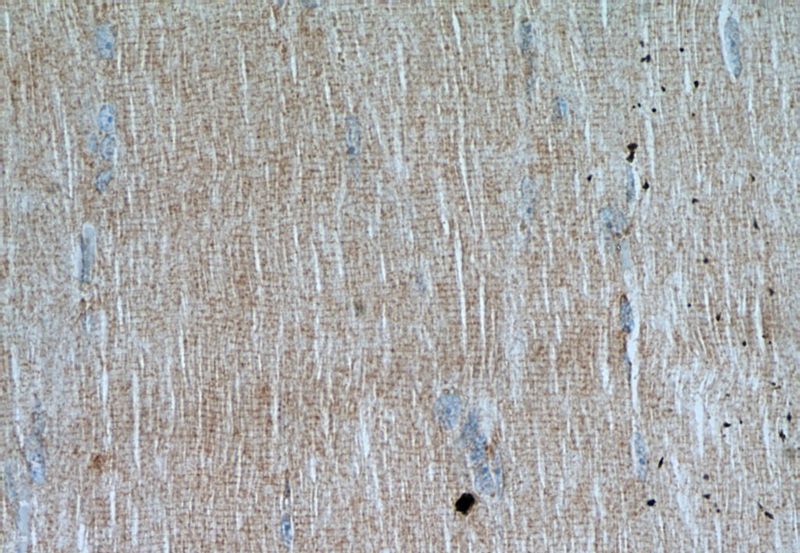 Immunohistochemical of paraffin-embedded human skeletal muscle using Catalog No:113404(NUBP2 antibody) at dilution of 1:50 (under 40x lens)