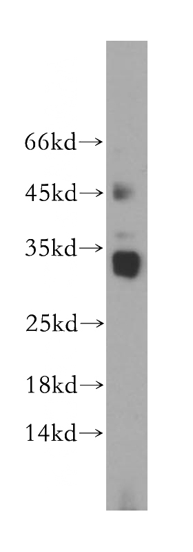 Jurkat cells were subjected to SDS PAGE followed by western blot with Catalog No:107931(AKAP14 antibody) at dilution of 1:400