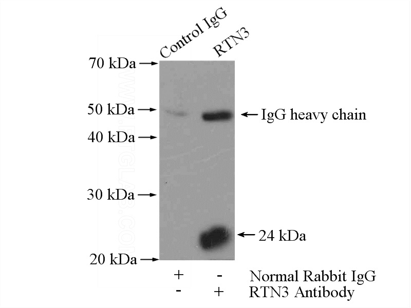 IP Result of anti-RTN3 (IP:Catalog No:114863, 4ug; Detection:Catalog No:114863 1:400) with HeLa cells lysate 2000ug.
