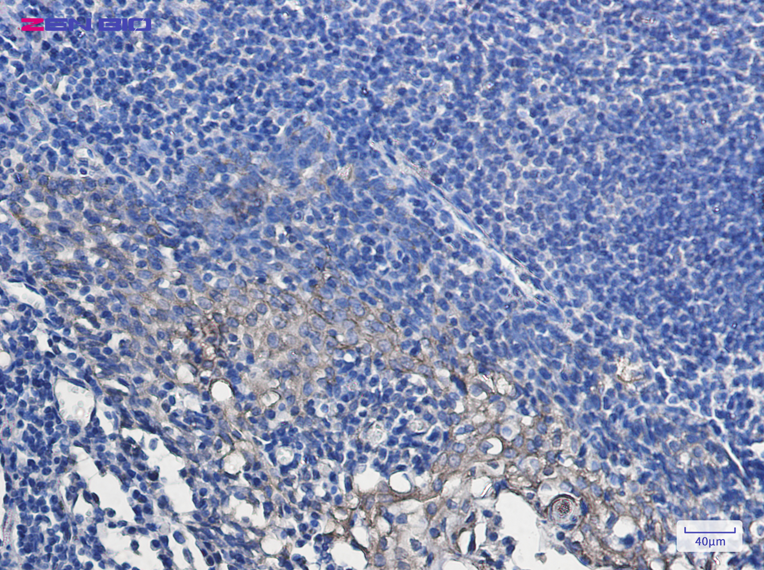 Immunohistochemistry of Hsp27 in paraffin-embedded Human tonsil using Hsp27 Rabbit pAb at dilution 1/50