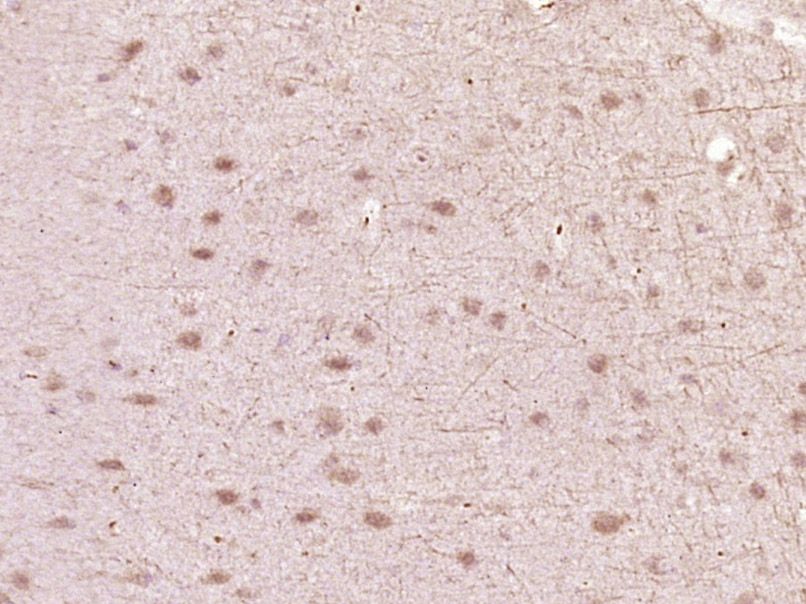 Fig1: Paraformaldehyde-fixed, paraffin embedded (Mouse brain); Antigen retrieval by boiling in sodium citrate buffer (pH6.0) for 15min; Block endogenous peroxidase by 3% hydrogen peroxide for 20 minutes; Blocking buffer (normal goat serum) at 37℃ for 30min; Antibody incubation with (HIPK1) Polyclonal Antibody, Unconjugated at 1:400 overnight at 4℃, followed by operating according to SP Kit(Rabbit) (sp-0023) instructionsand DAB staining.