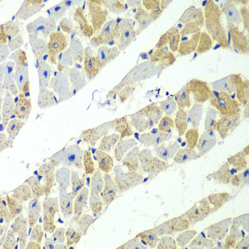 Immunohistochemistry - SERPINH1 Polyclonal Antibody 
