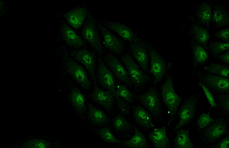 Immunofluorescent analysis of SH-SY5Y cells using Catalog No:111809(INTS7 Antibody) at dilution of 1:50 and Alexa Fluor 488-congugated AffiniPure Goat Anti-Rabbit IgG(H+L)